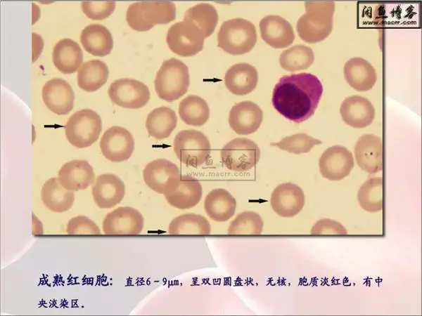 临床血液学检验_实验考试复习(图册)