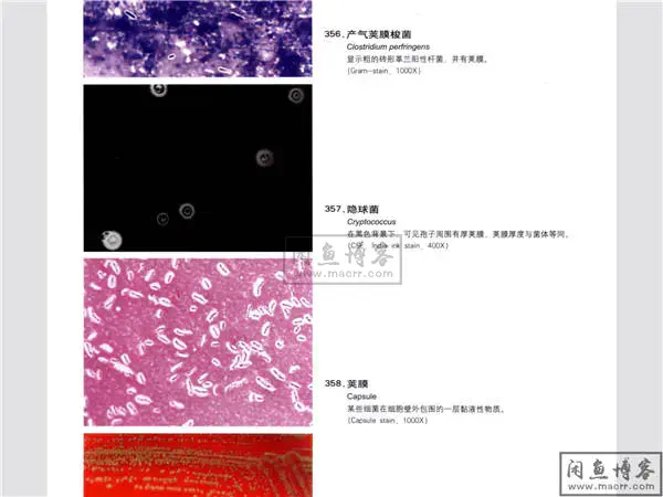 实验诊断学彩色图谱[叶千红](血液学检验+常规检验+微生物寄生虫）