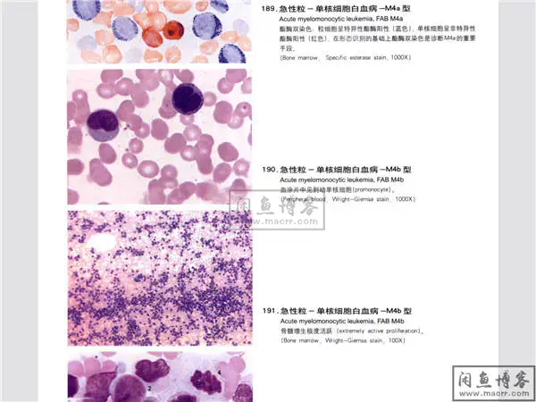 实验诊断学彩色图谱[叶千红](血液学检验+常规检验+微生物寄生虫）
