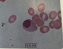 职称考试初级检验士检验师中级检验师必考的图片题目