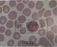 职称考试初级检验士检验师中级检验师必考的图片题目