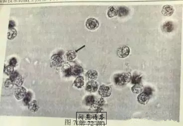 职称考试初级检验士检验师中级检验师必考的图片题目