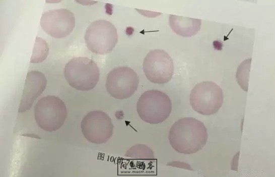 职称考试初级检验士检验师中级检验师必考的图片题目
