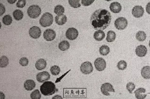 职称考试初级检验士检验师中级检验师必考的图片题目