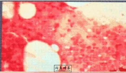 职称考试初级检验士检验师中级检验师必考的图片题目