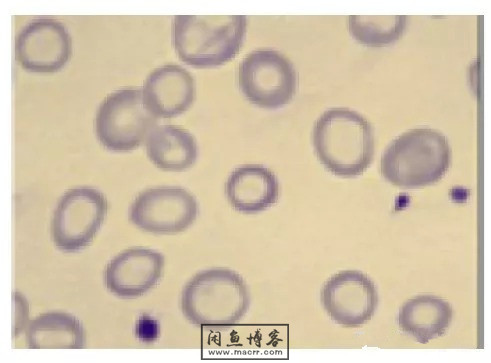 职称考试初级检验士检验师中级检验师必考的图片题目