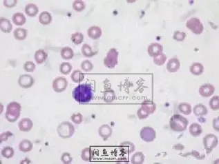 职称考试初级检验士检验师中级检验师必考的图片题目