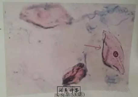 职称考试初级检验士检验师中级检验师必考的图片题目