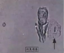 职称考试初级检验士检验师中级检验师必考的图片题目